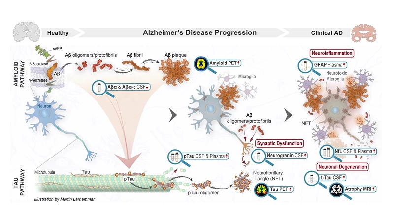 Biomarkörer i klinisk praxis