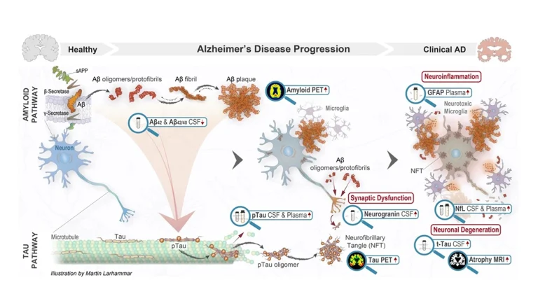 Biomarkörer i klinisk praxis hero