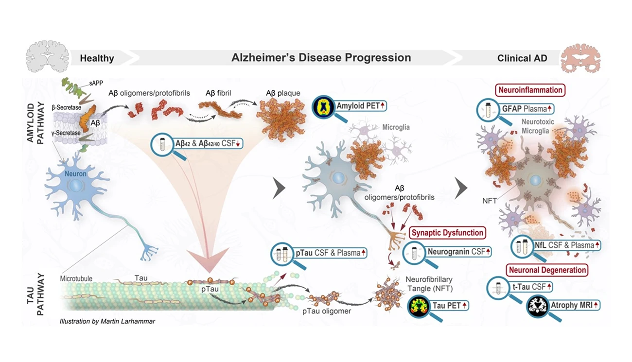 Biomarkörer i klinisk praxis hero