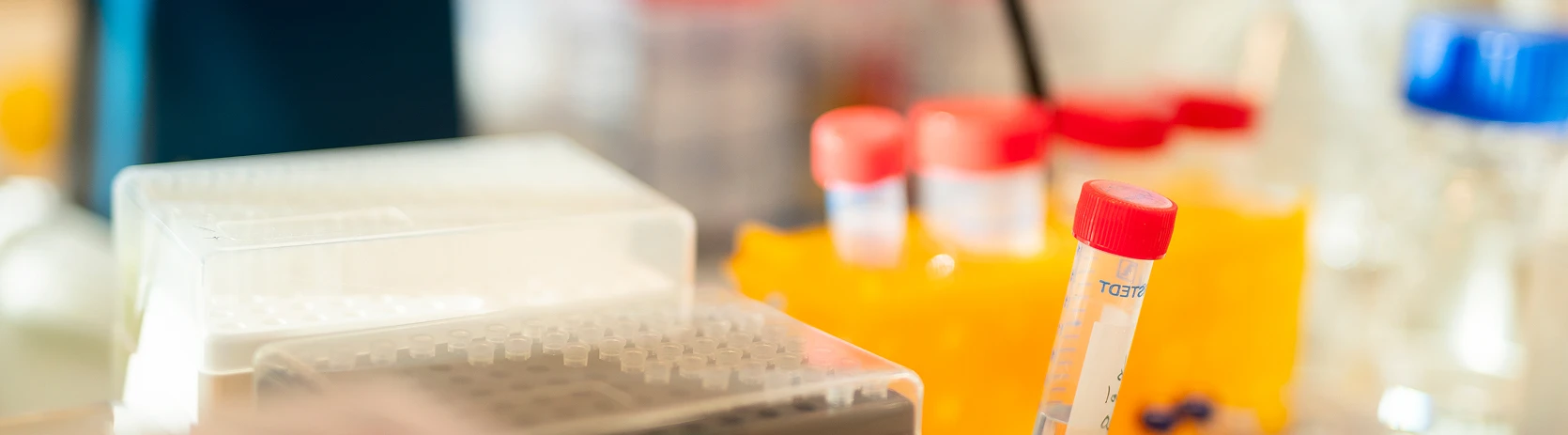 Biomarkörer vid Alzheimers sjukdom hero