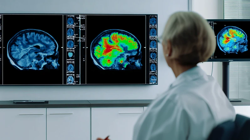 Från kliniskt syndrom till biologiskt definierad diagnos med biomarkörer